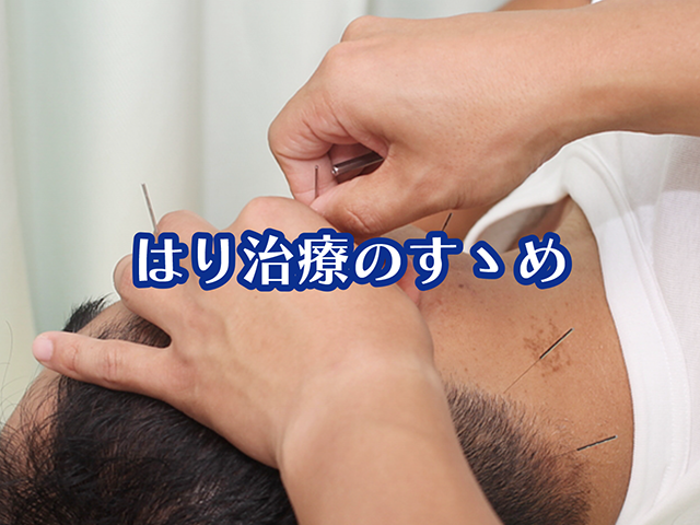 はり治療（鍼治療）のすゝめ